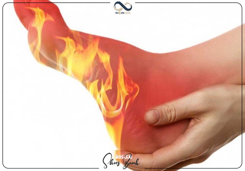 داغ شدن کف پا